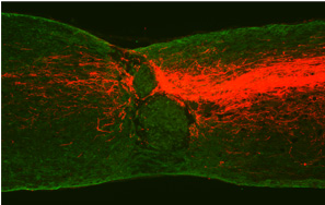 img_corticospinal-axons